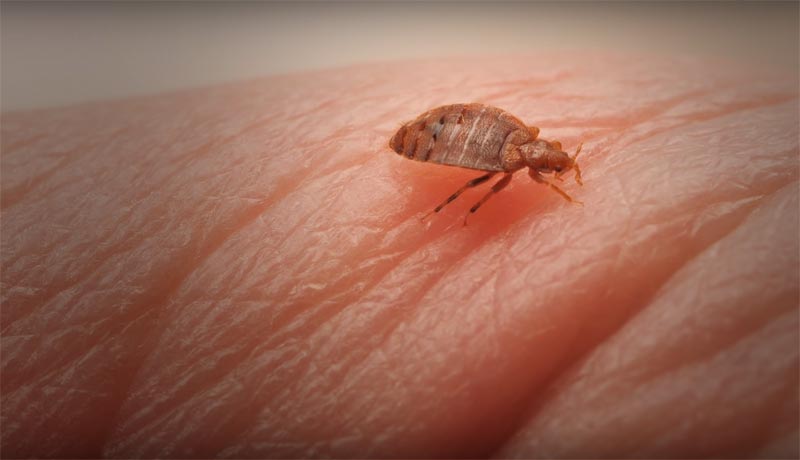 Bed bugs on skin